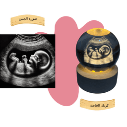 مثال 3
